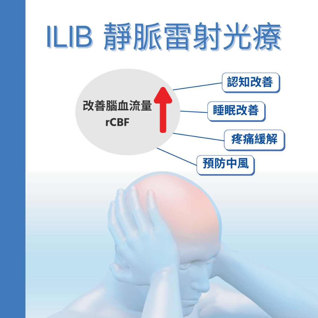 ILIB靜脈雷射技術 在中風治療中的應用