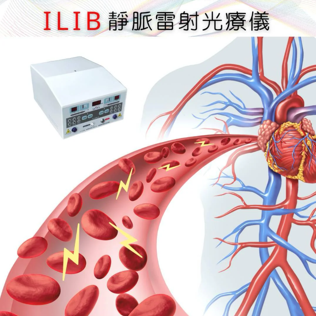 ILIB靜脈雷射光療:恢復健康的有效助手