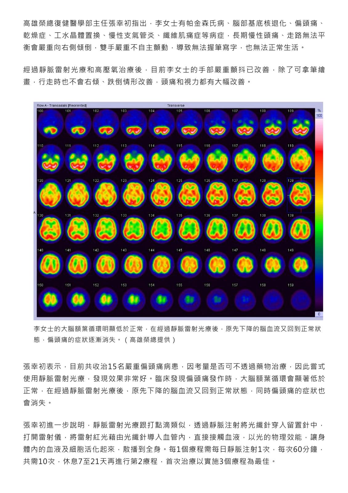 告別頭痛困擾:創新雷射療法帶來希望